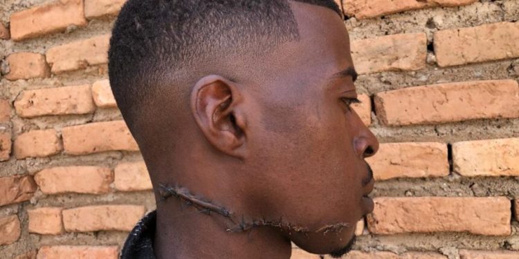 Muhanga: Umusore yabujije bagenzi be kurya amandazi y’abandi batishuye bahita bamukeba ijosi