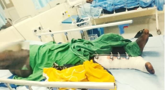 Muhanga: Umuturage arashinja Gitifu w’Akagali gufatanya na Mutekano kumukubita bakamugira intere