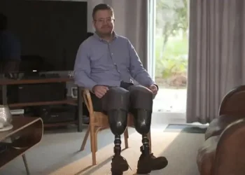 U Bwongereza: Umuganga yikase amaguru ngo abone amafaranga none byamukozeho