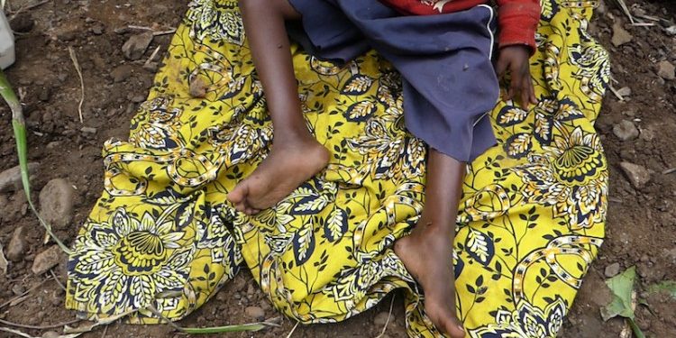 Rusizi: Umwana w’imyaka 9 ararembye nyuma yo kugongwa n’imodoka ya World Vision agatereranwa